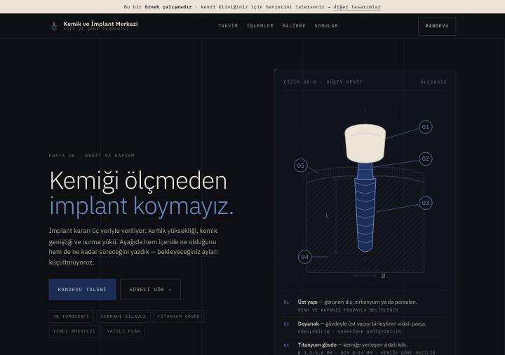 İmplant tasarımı — karbon zemin, teknik çizim, lacivert vurgu